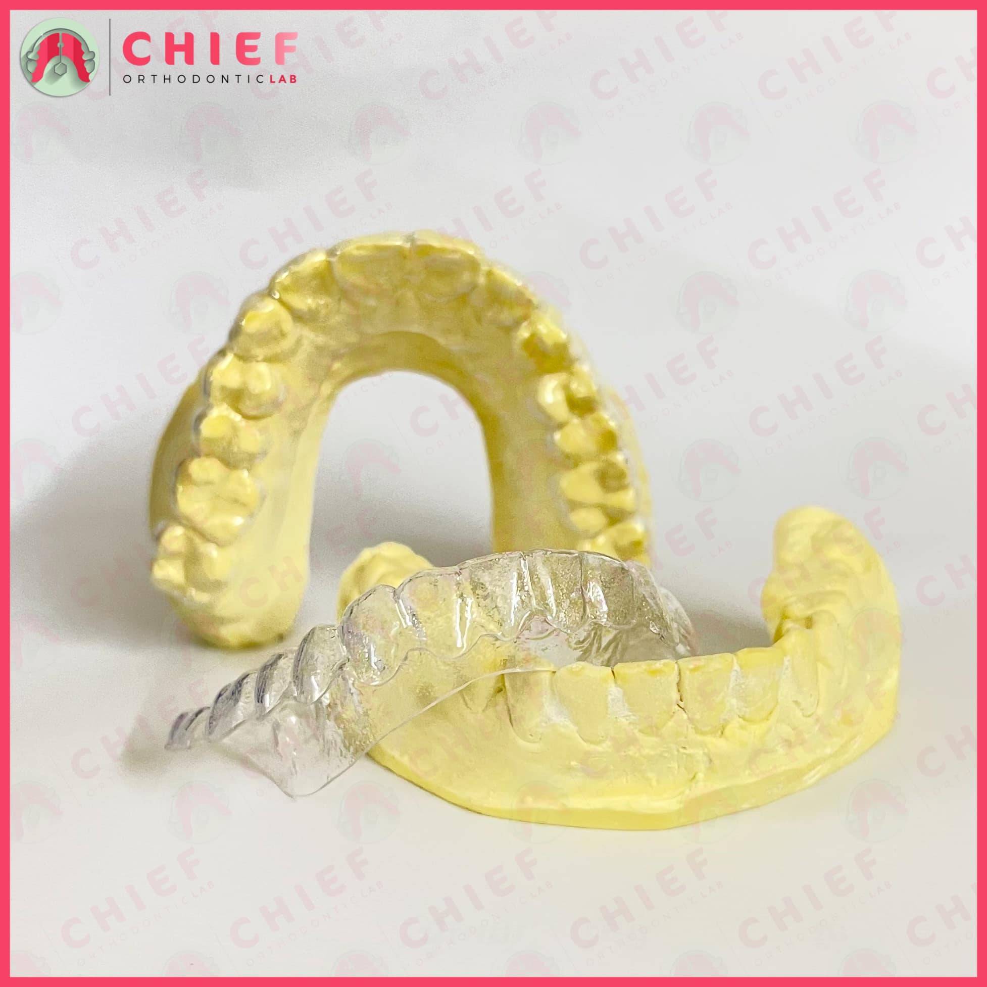 👄 Clear Retainers 👄 / Vacuum... - Chief Orthodontic Lab