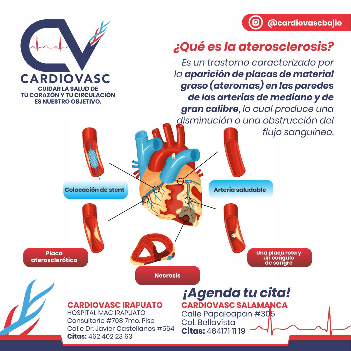 ¿Qué es la... - Cardiovasc Centro Cardiovascular | Facebook