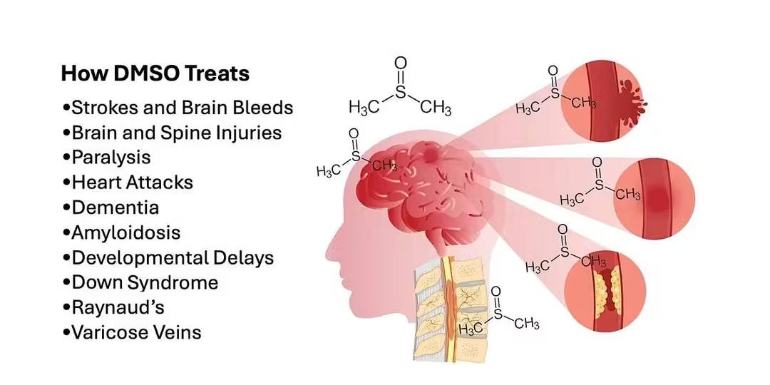 dmso and glutathione not a proven treatment for pain or cancer Size:1EA bpc 157 peptide pills Histamine Intolerance
