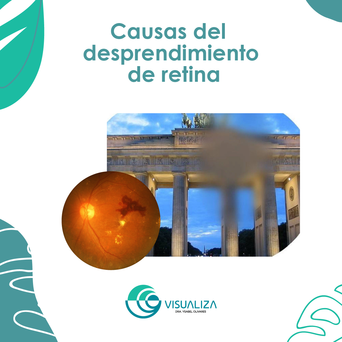 Causas del... - Visualiza Centro Oftalmológico | Facebook