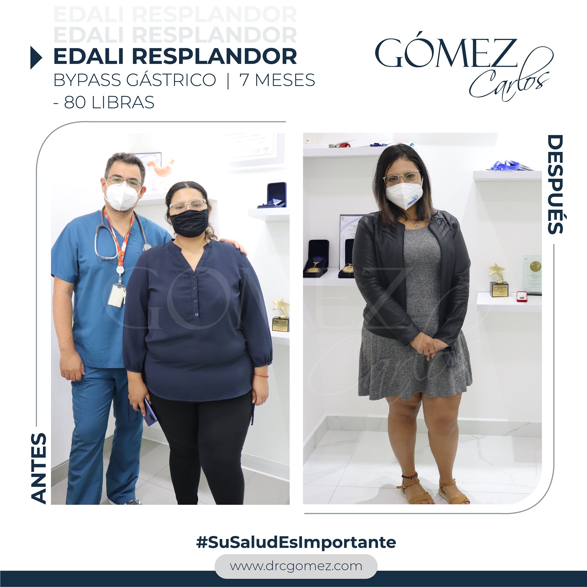¿Recuerdan a Edalí? . Ha perdido 80... - Dr. Carlos Gómez | Facebook