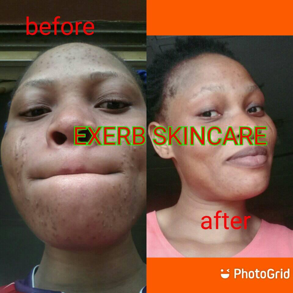 Exerb skincare & spa
