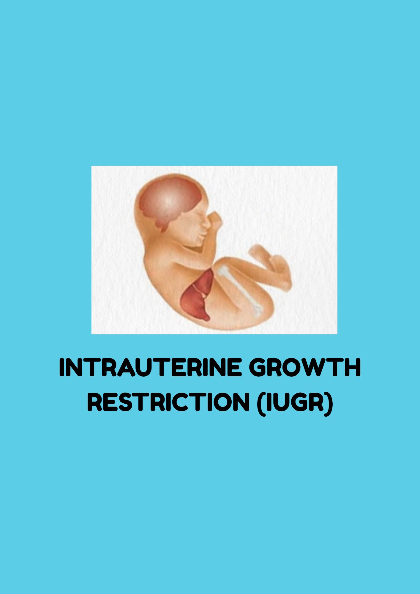 Ma - Intrauterine Growth Restriction (IUGR) Failure of a fetus to reach ...