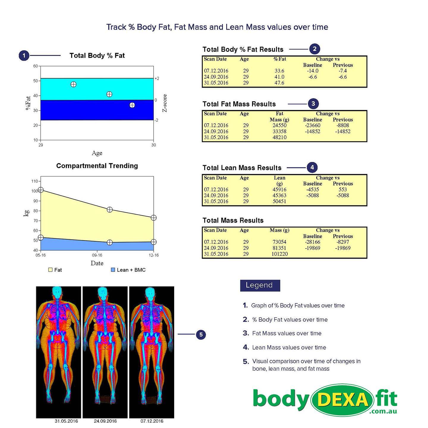 Body - Dual energy x-ray absorptiometry (DEXA) is an innovative and ...
