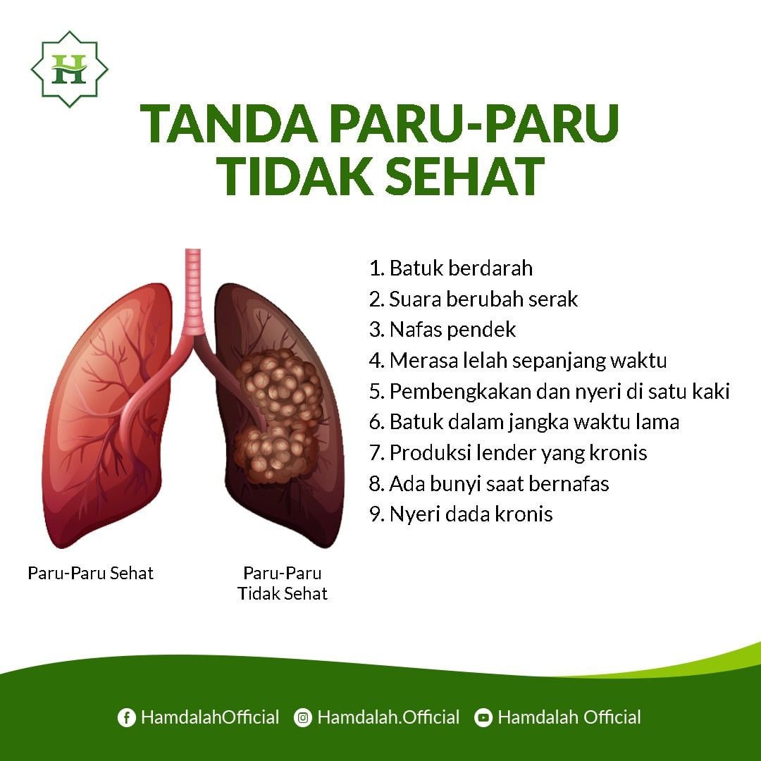 Hamdalah - Sering mengalami gejala pada gambar? Bisa jadi karena rokok ...