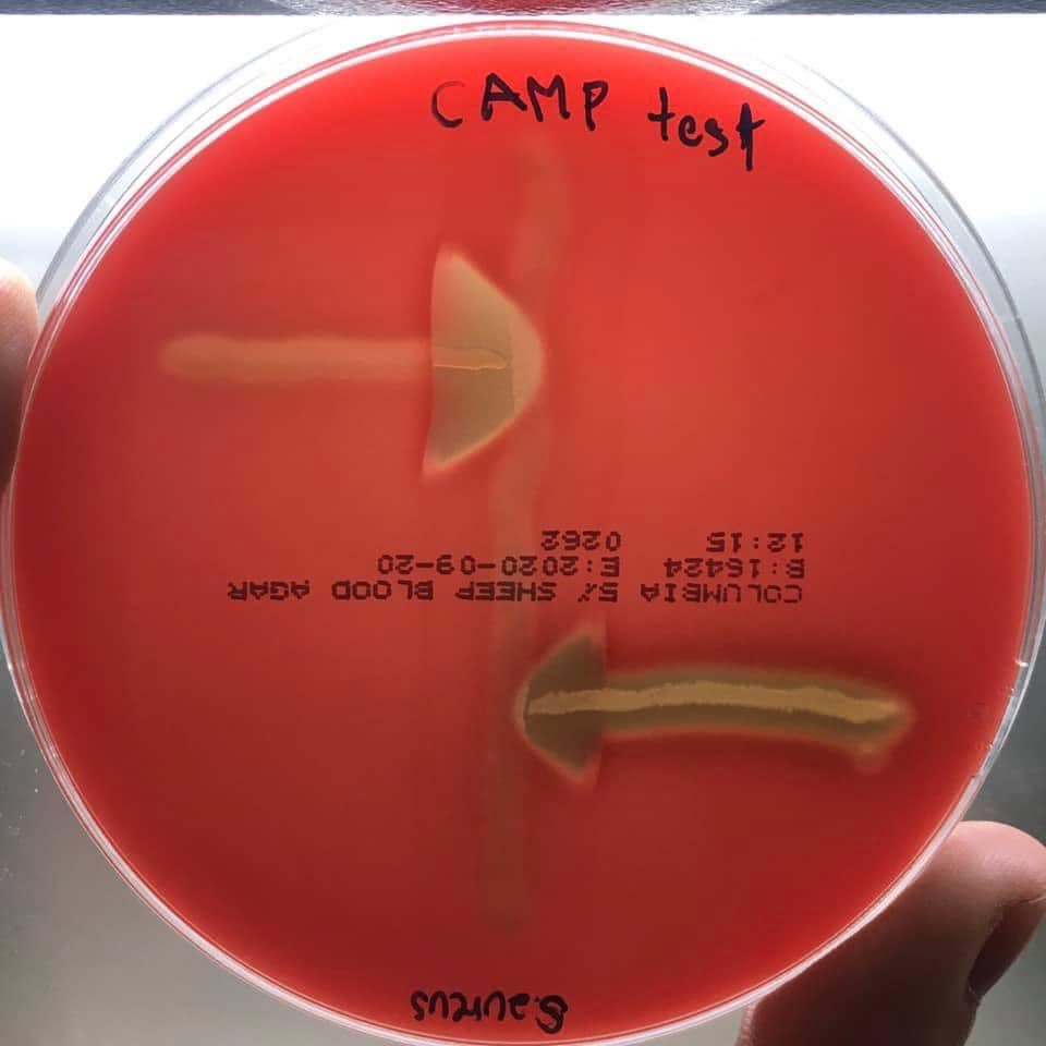 CAMP test... - Lab Technician AHS BUU | Facebook