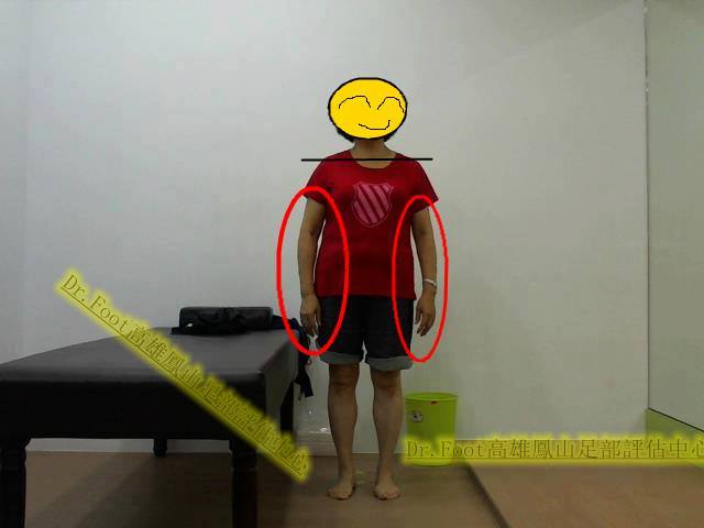 平時愛翹腳、三七步站姿、慵懶坐... - Dr.Foot 台中南屯足部評估中心【足部檢測、訂製鞋墊、矯正鞋、足弓墊、健康鞋】