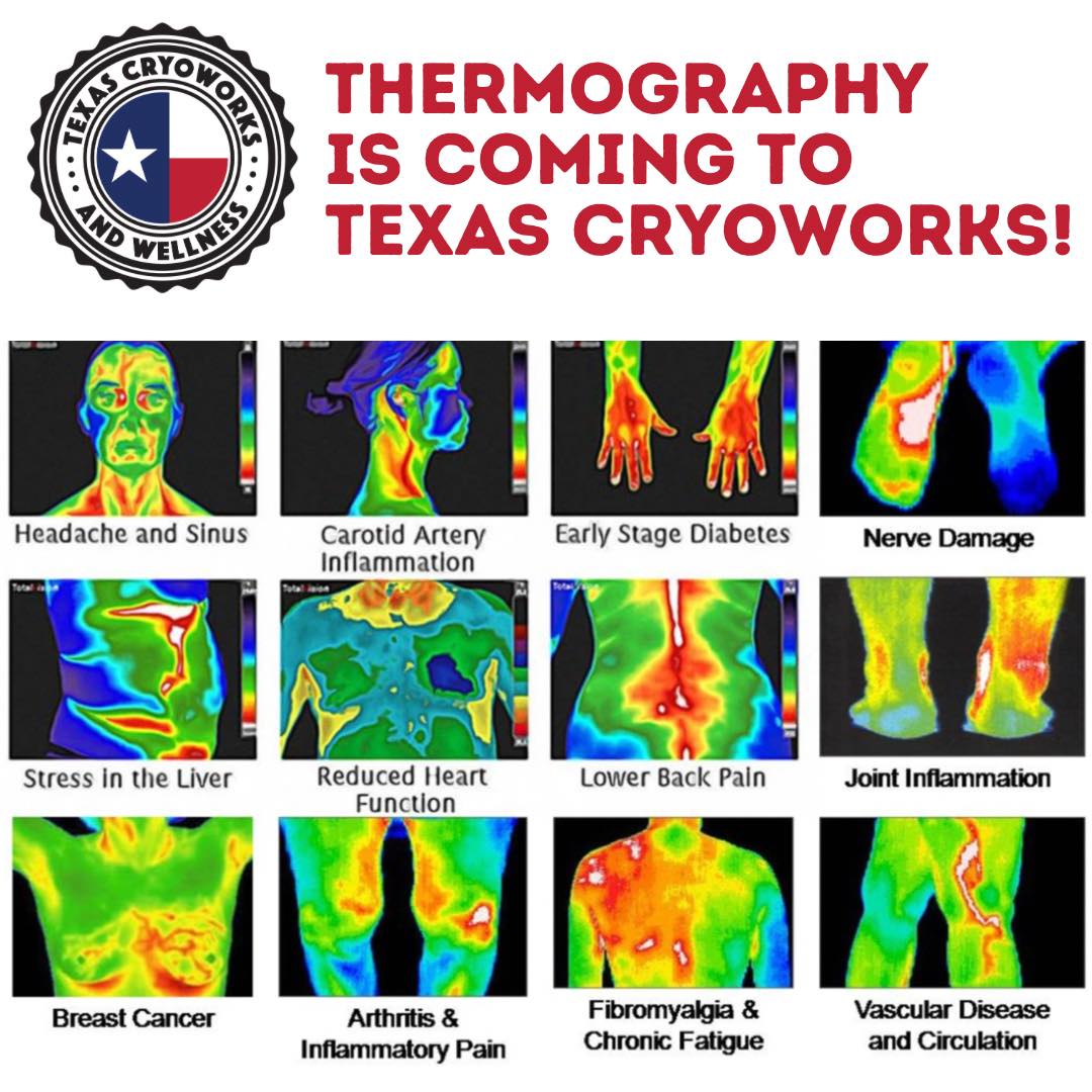 Texas - THERMOGRAPHY IS COMING TO TEXAS CRYOWORKS & WELLNESS CENTER ...
