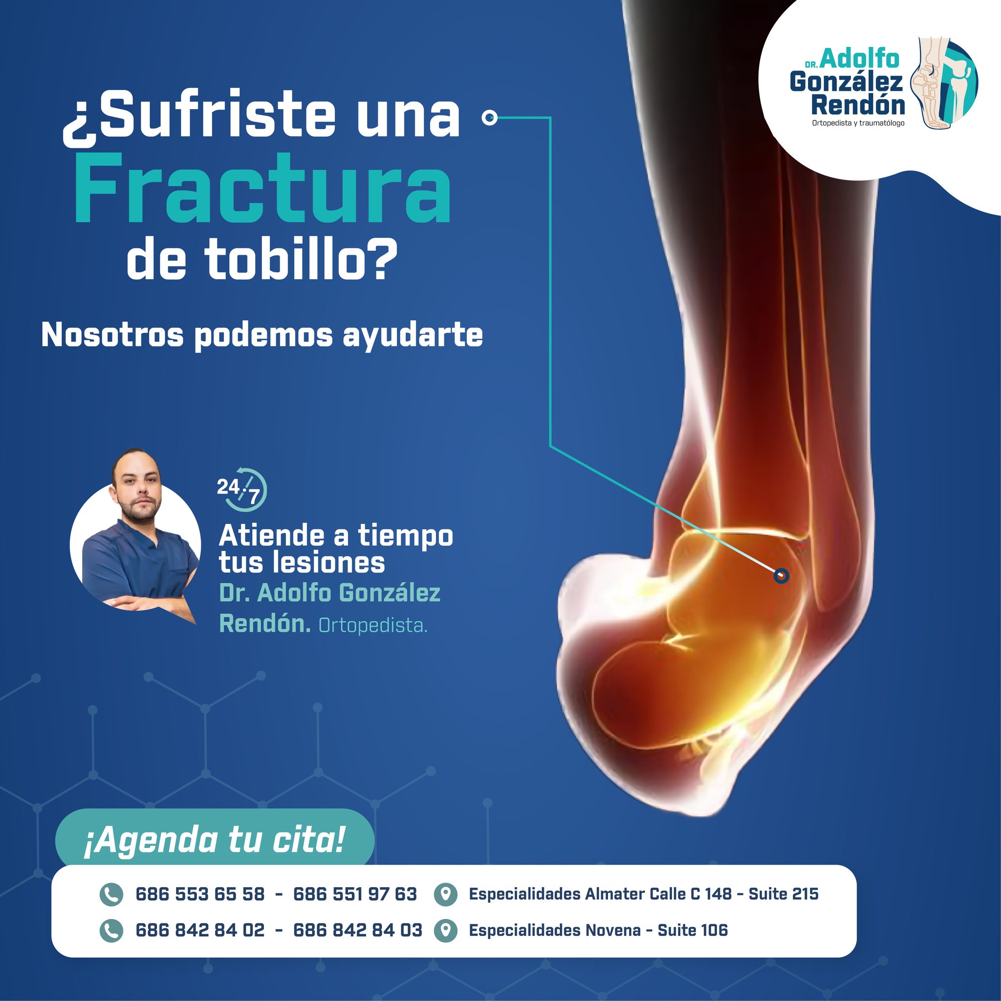 Un tobillo roto o... - Dr. Adolfo González Rendón-Ortopedista | Facebook