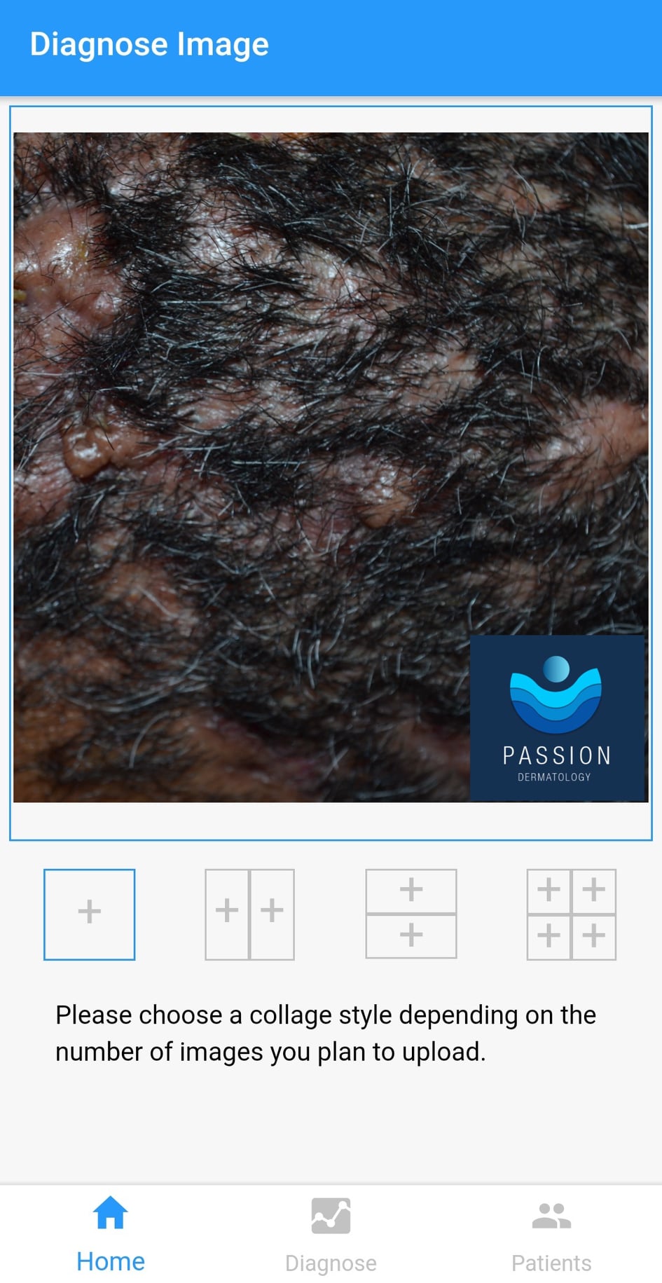 What is this ? (Courtesy of... - Dermatology News Daily