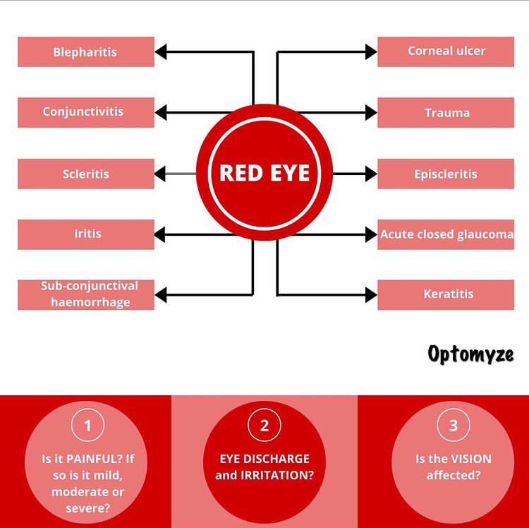 D.D. Of Red Eye: Photo... - Ophthalmology-Notes And Synopses | Facebook