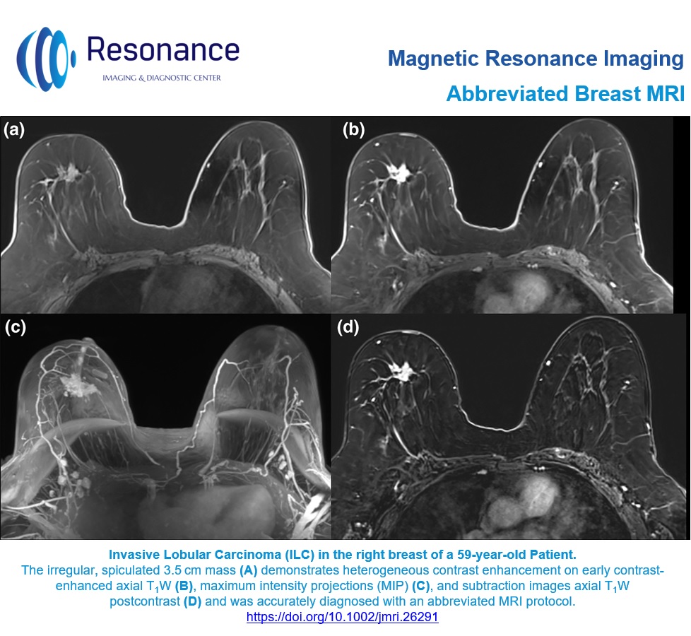 Resonance Imaging and Diagnostic Center - Abbreviated Breast MRI (AB ...