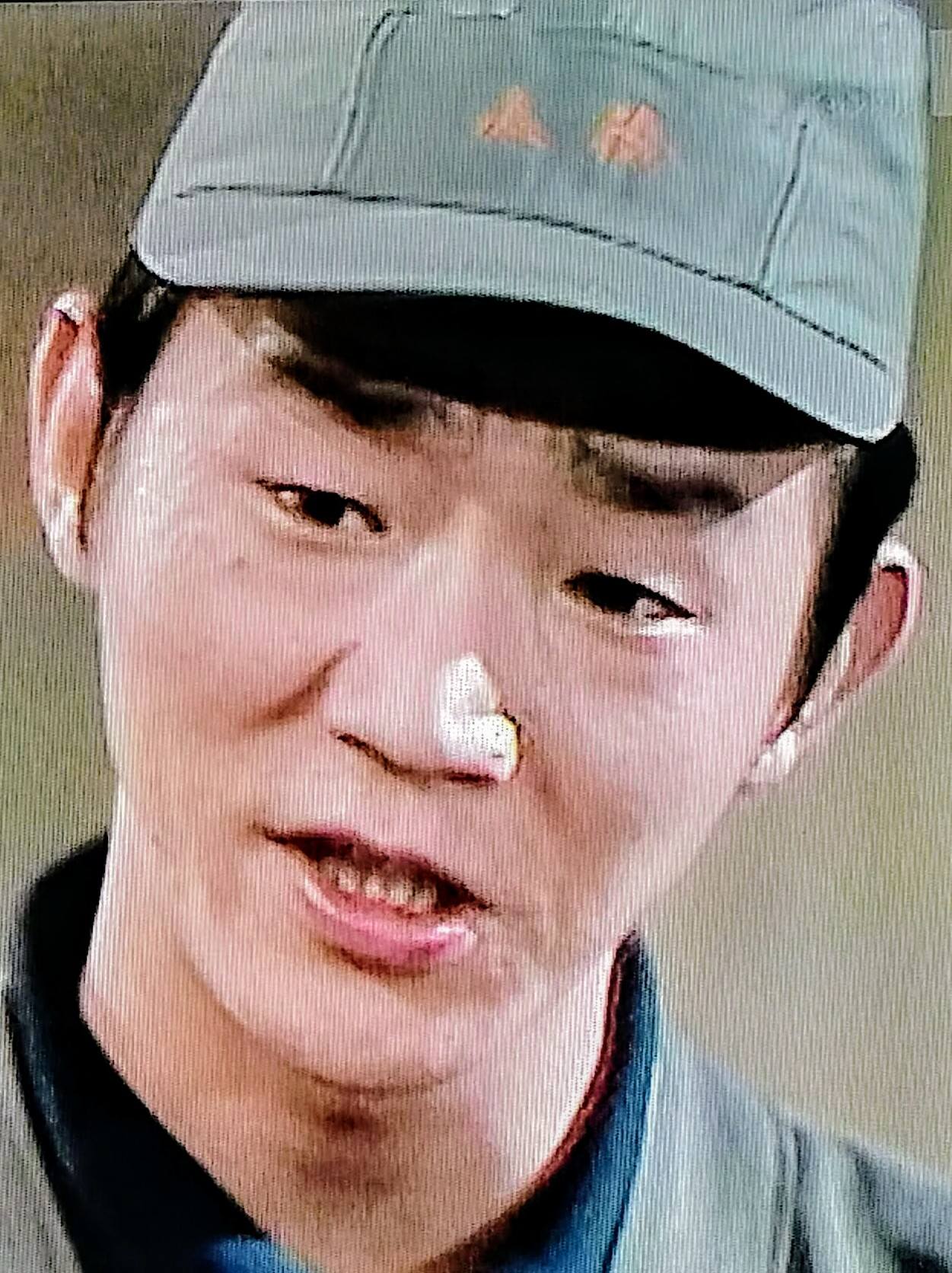 松山 英太郎 死因