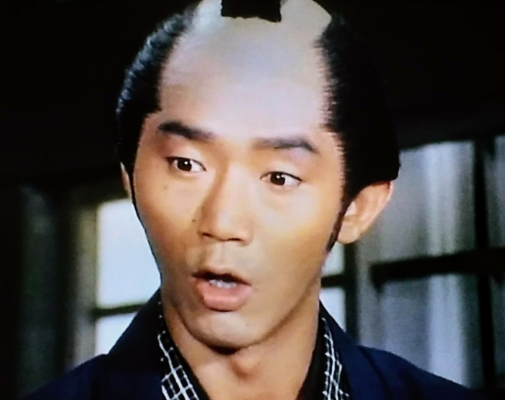 松山 英太郎 死因