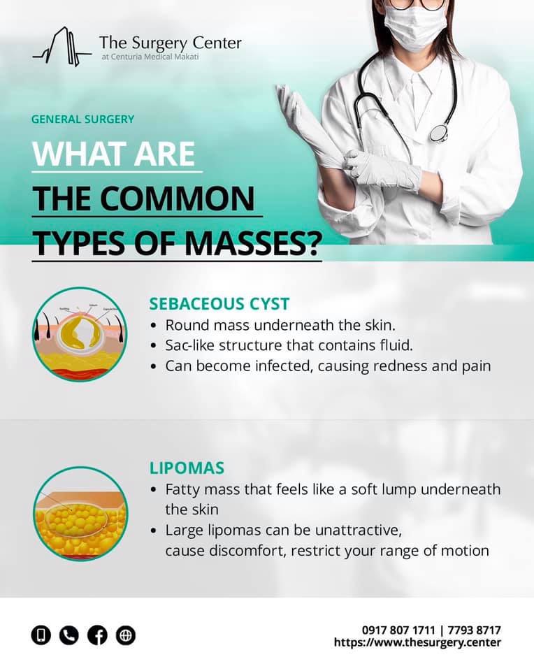 The Surgery - 🔴 People can have different kinds of “lumps and bumps” on ...
