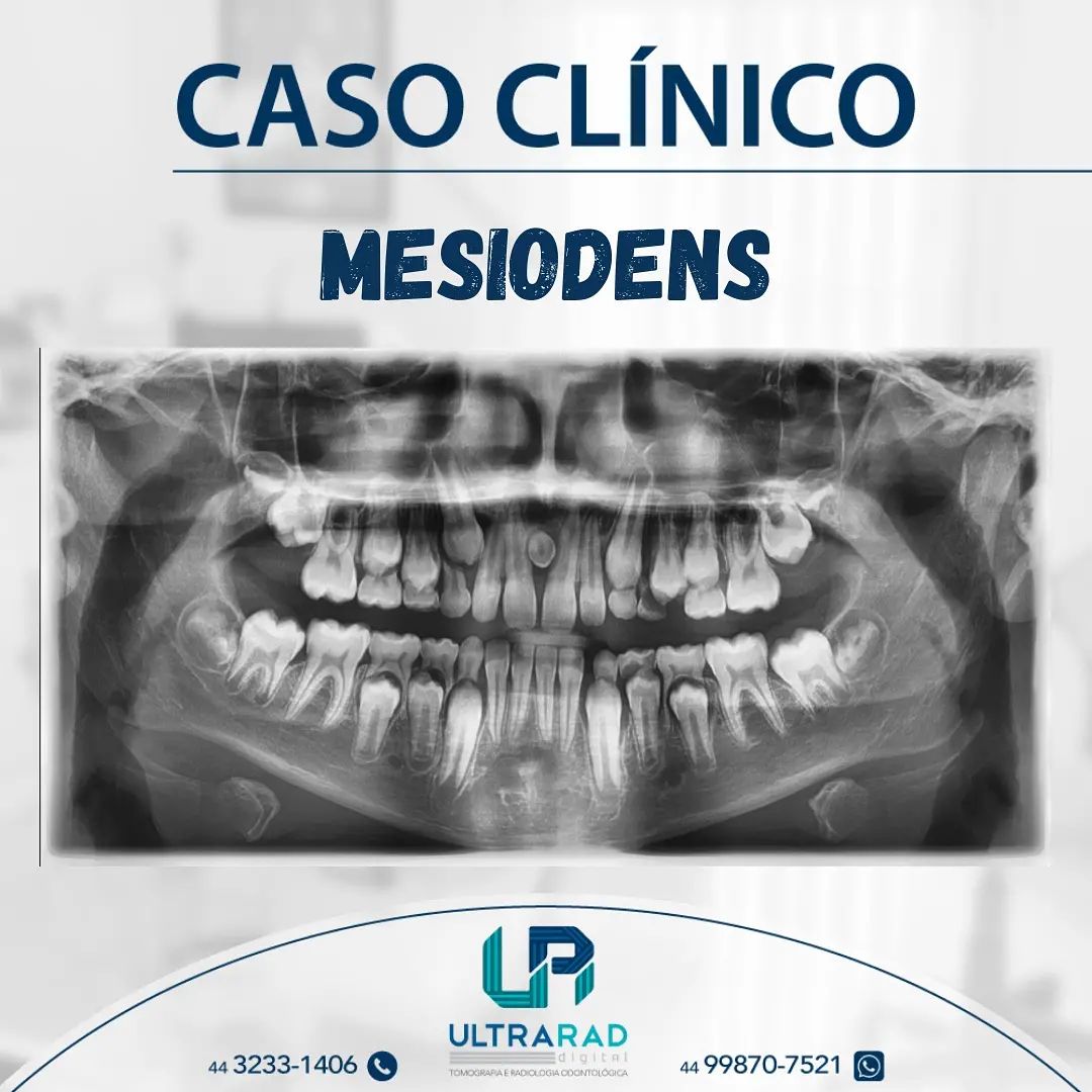 🦷CASO... - Ultrarad - Radiologia Odontológica Digital | Facebook