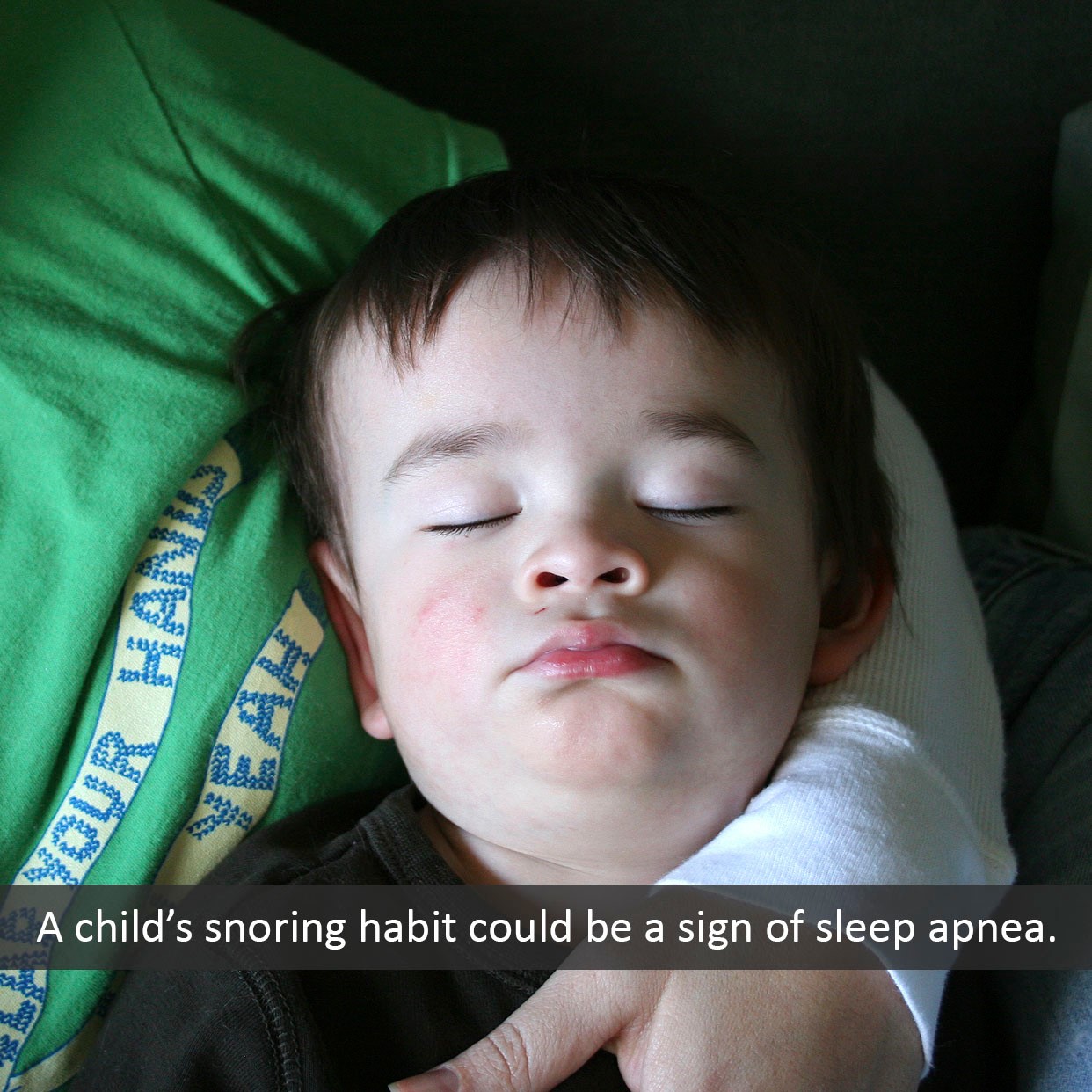 Parkview - UP TO 20 PERCENT of habitually snoring children have sleep ...