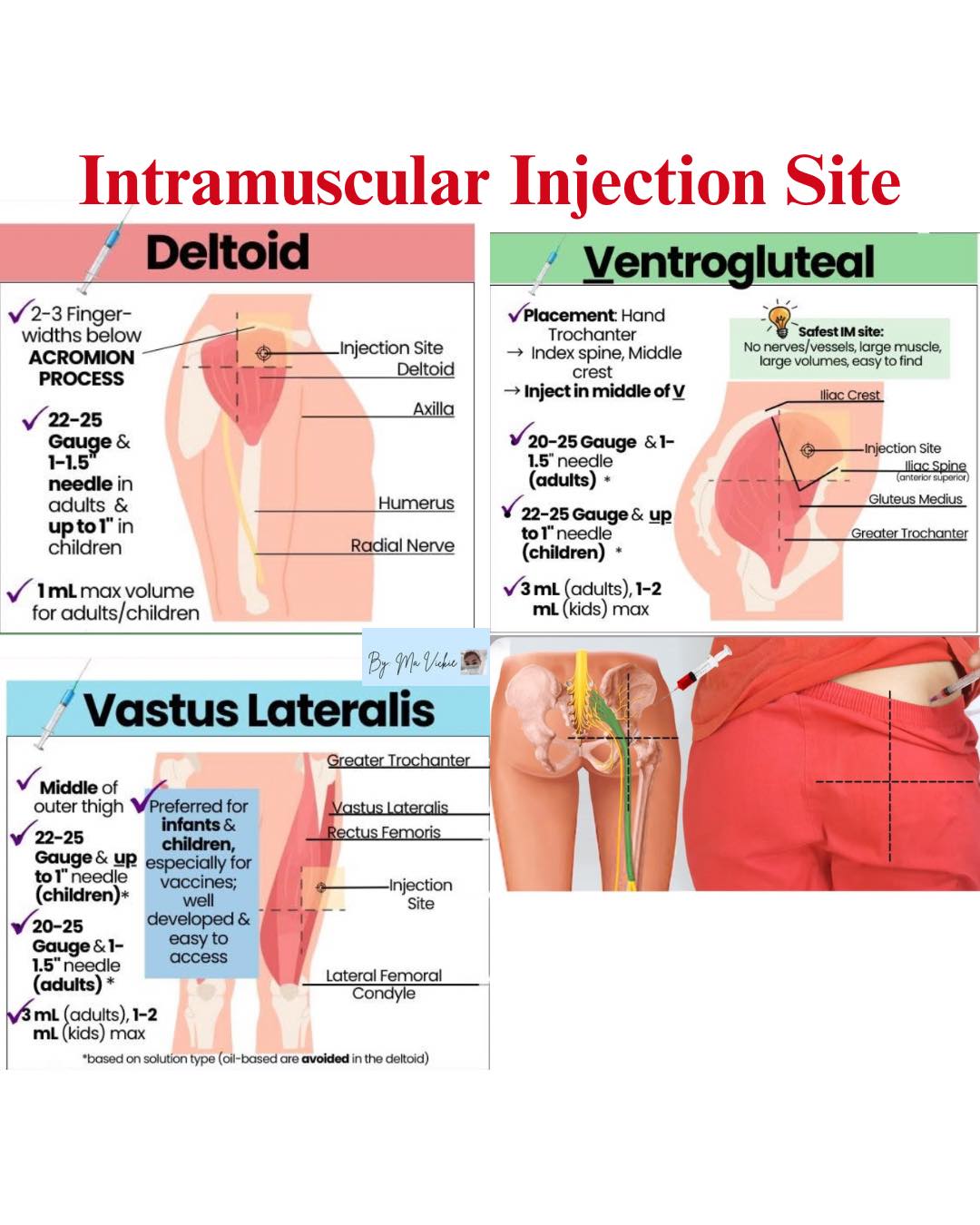 Philippine Registered Nurses Society | IM injection Sites💉🧐🩺👇 | Facebook