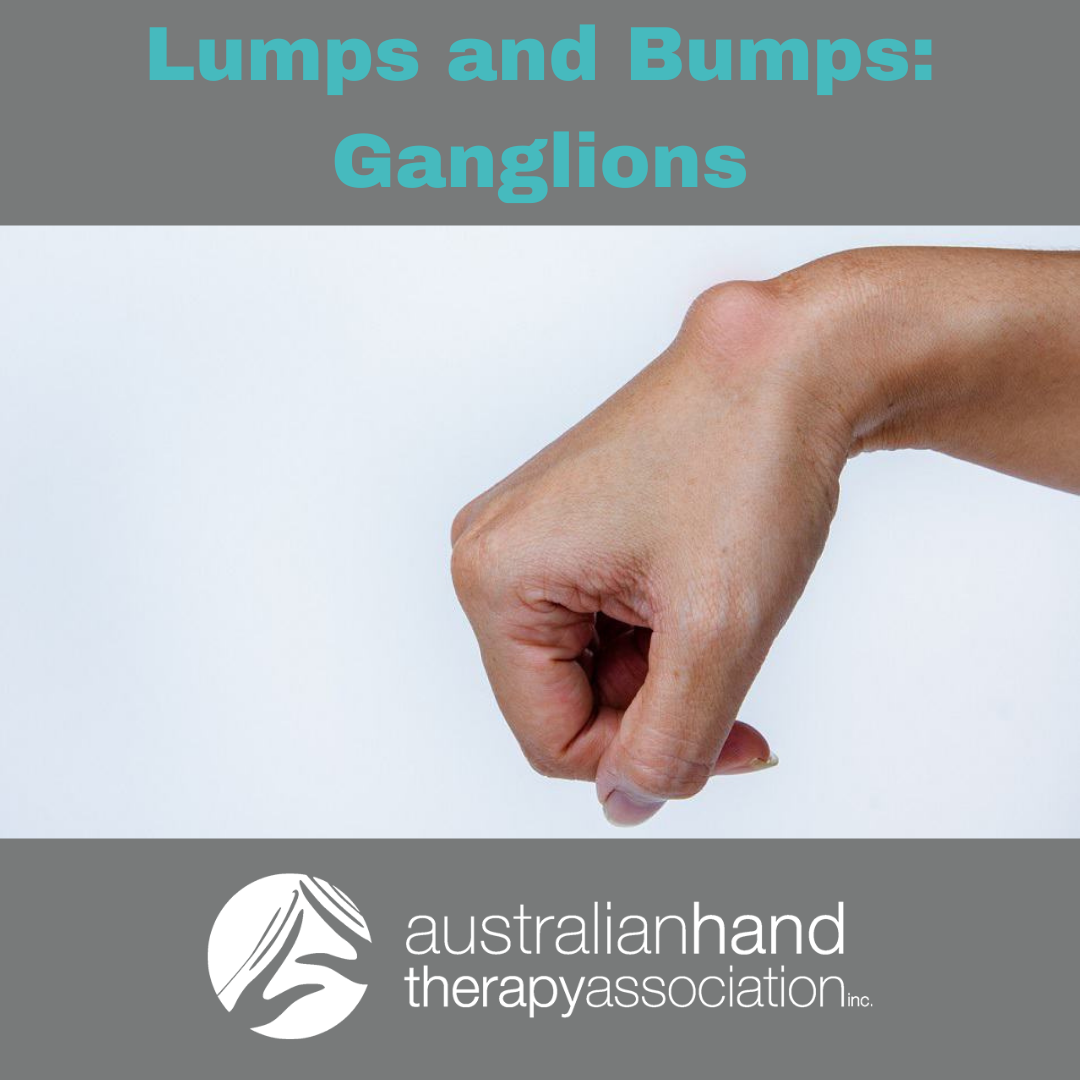 There are many... - Australian Hand Therapy Association
