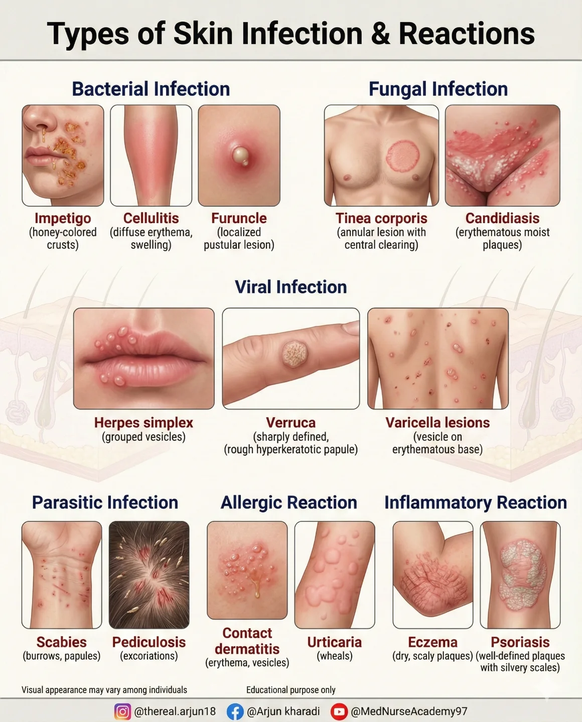 Arjun - Skin infections and reactions present with characteristic ...
