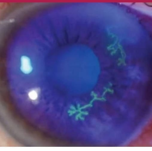Optometrist Jobs | Name of this muscle of iris | Facebook