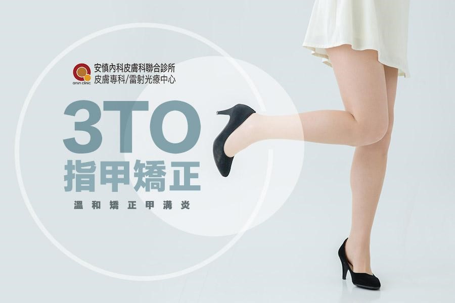 新竹安慎皮膚科/醫學美容/雷射光療中心 - 「甲溝炎好痛 但拔指甲感覺更痛 怎麼辦？」 誰說矯正甲溝炎一定要拔指甲？ 推薦您溫和矯正甲溝炎的 ...