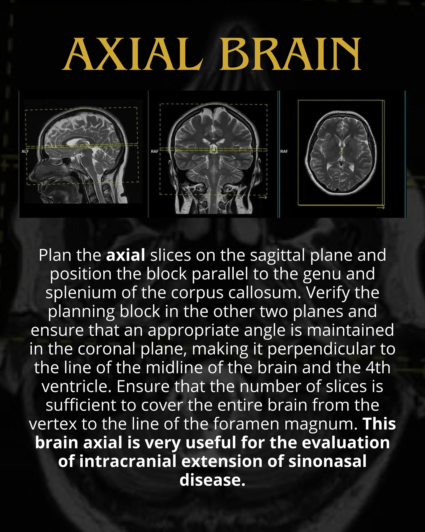 Sobat Radiology - Sobat Radiology added a new photo.