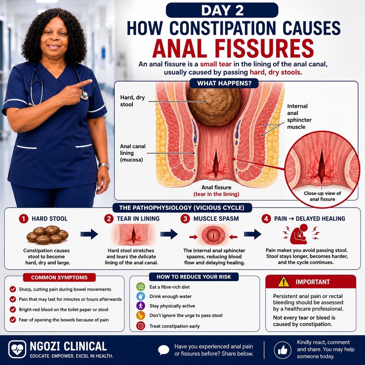 anal fissures glp 1 Fissures: Symptoms, Causes, Diagnosis, Treatment, and Prevention Causes, Symptoms & Treatment for