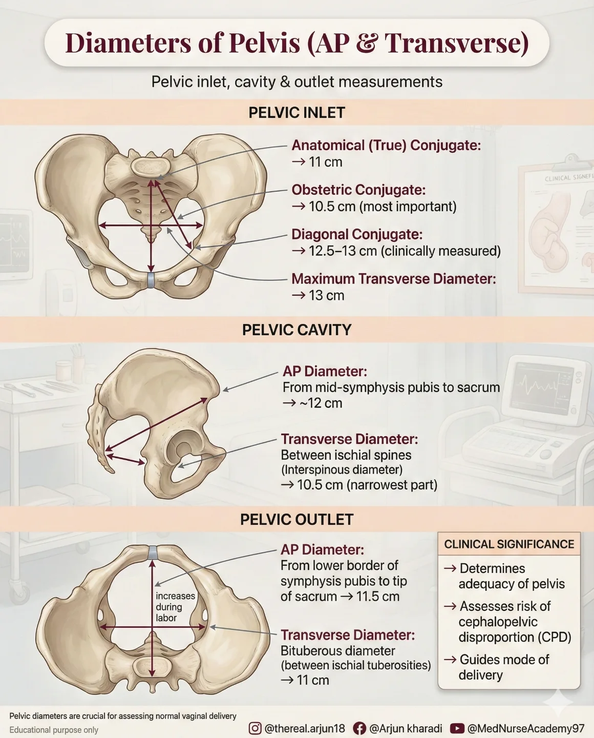 Arjun - Diameters of Pelvis (AP & Transverse) 📐 High-yield obstetrics ...
