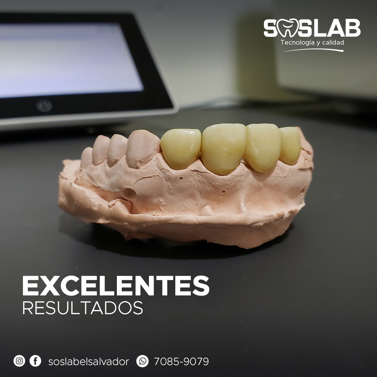 SOSLAB - Cada sonrisa transformada es un testimonio de nuestro ...