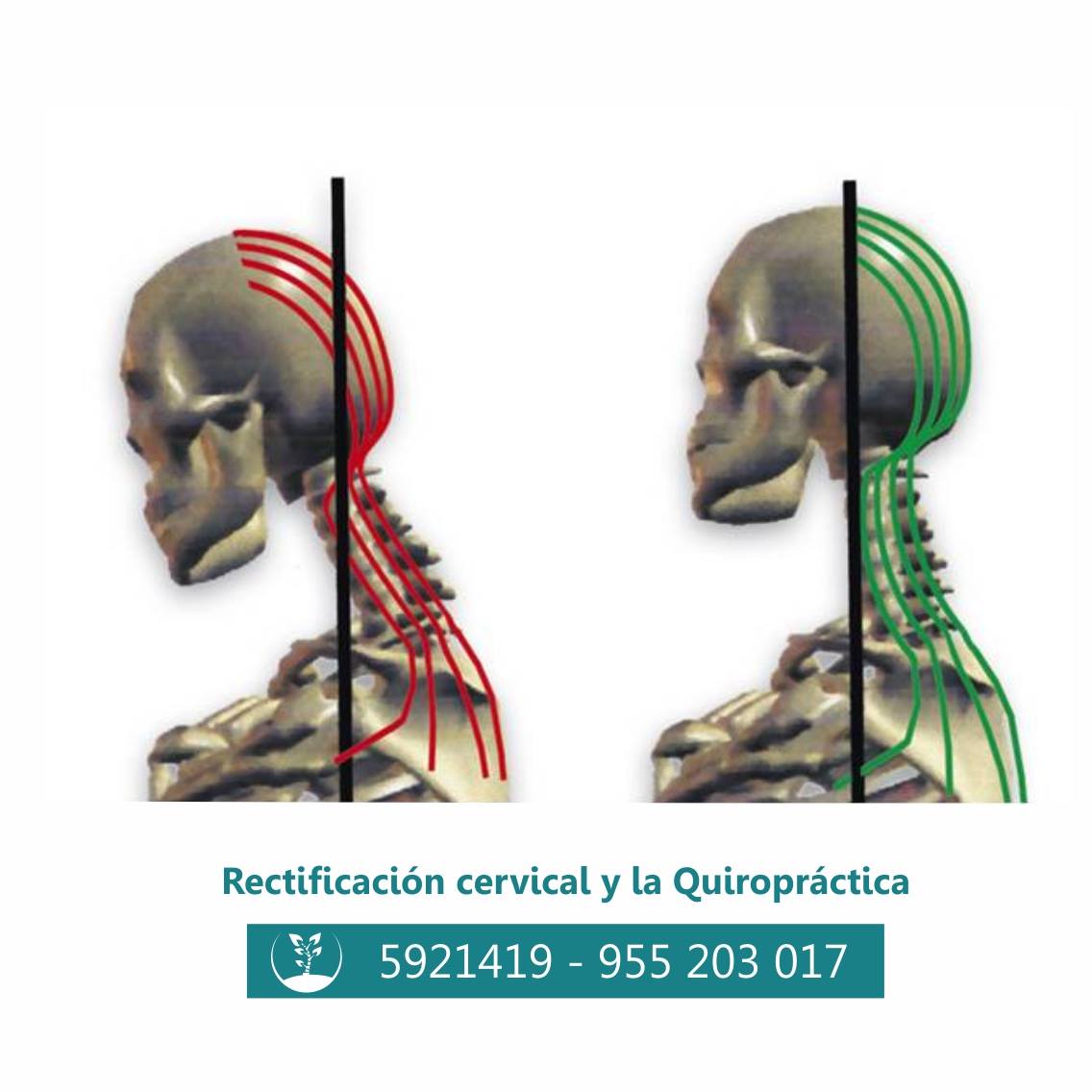 📣📣SABIAS... - Centro Quiropractico Stumvoll Sede San Borja