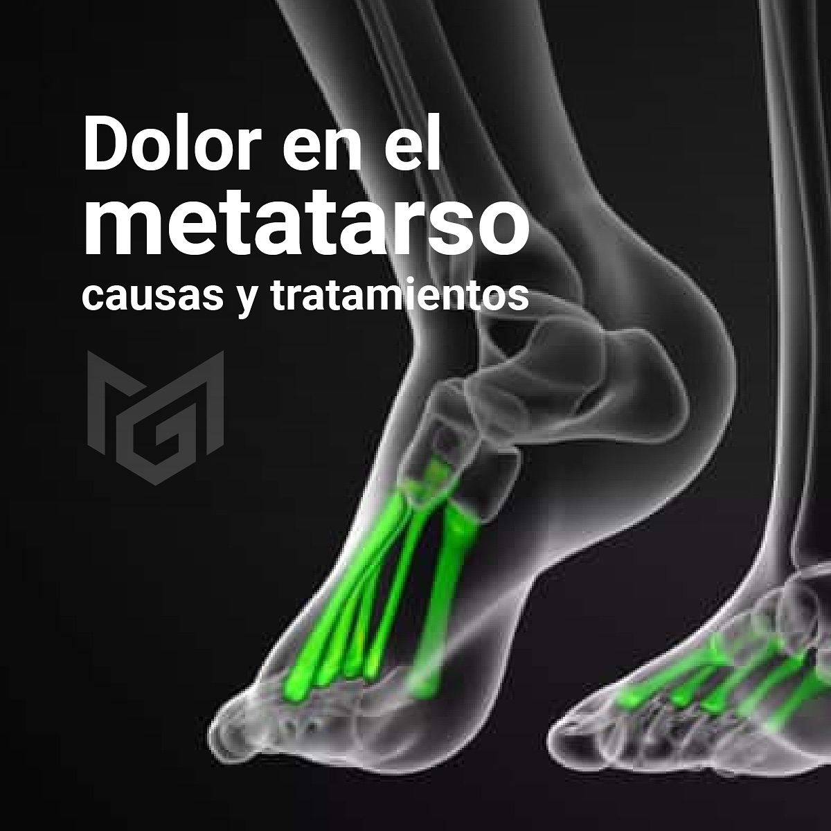 Dr.Mariano - La metatarsalgia es una patología que causa dolor en la ...