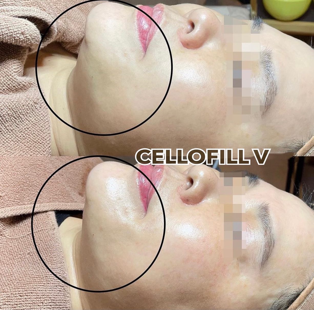 어떤 제품을 써도 살이 빠지지 않는다면 CELLOFILL V... - Cellofillofficial