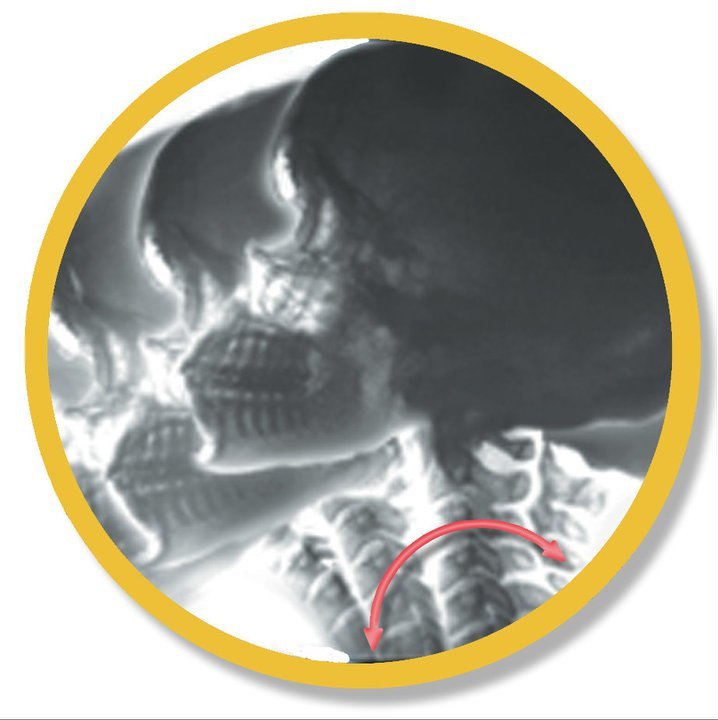 Digital Motion X-Ray (DMX) Of Michigan | Clawson MI
