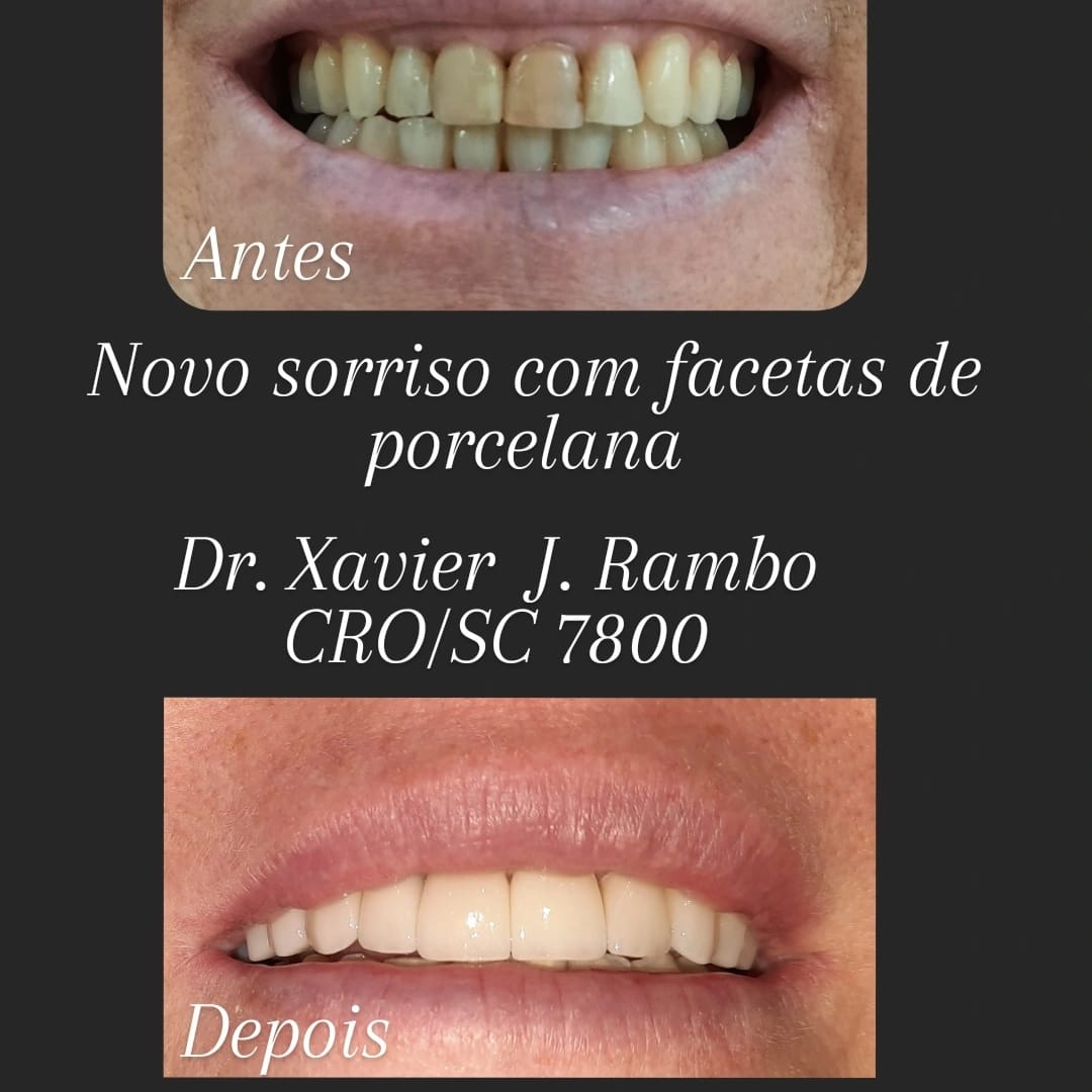 Consultório Odontológico Xavier José Rambo | Guaraciaba SC