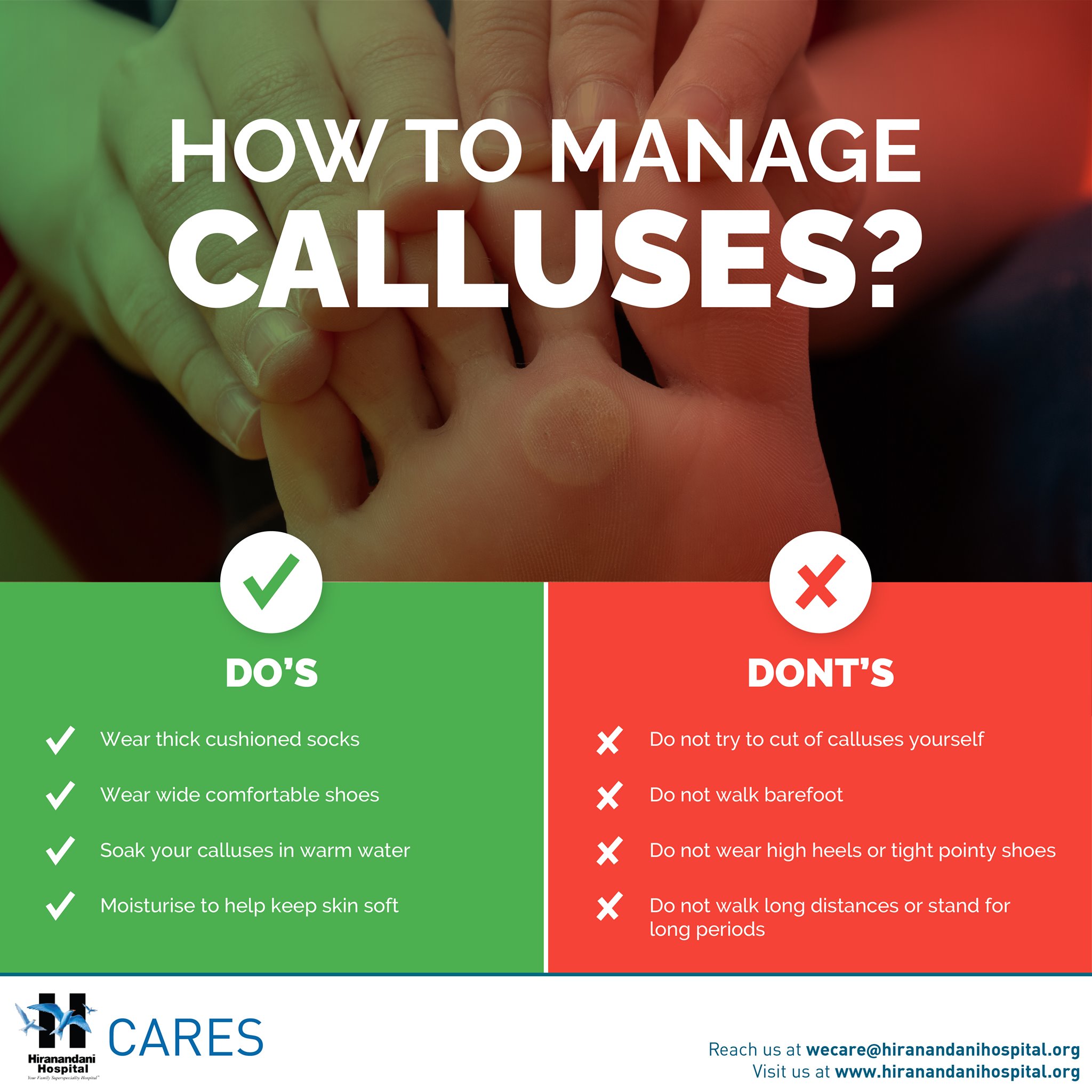 Dr - Calluses are thickened and hardened layers of skin that develop as ...