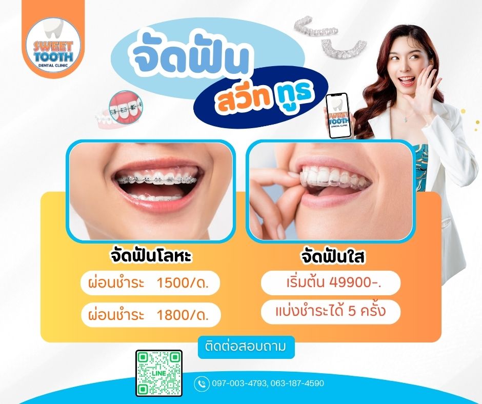 🔍จัดฟันสวีททูธ มี 2 แบบ 💕🦷 จัดฟันโลหะ จองโปรวันแรก เพียง 799-. ‼️ แบ่ง ...