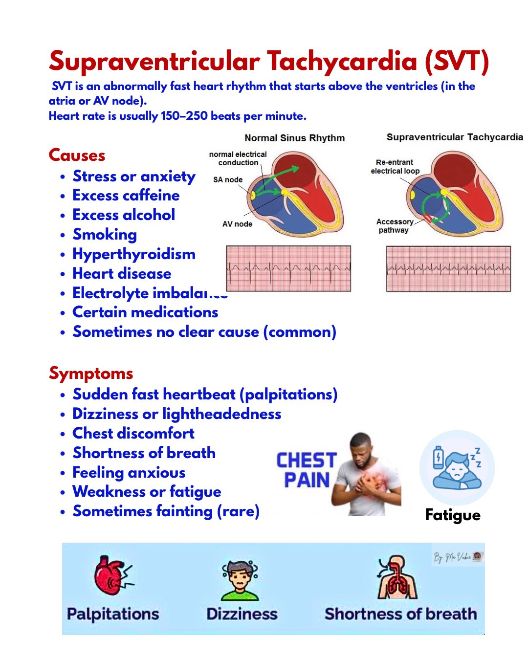 Understanding supraventricular tachycardia (SVT) symptoms and causes