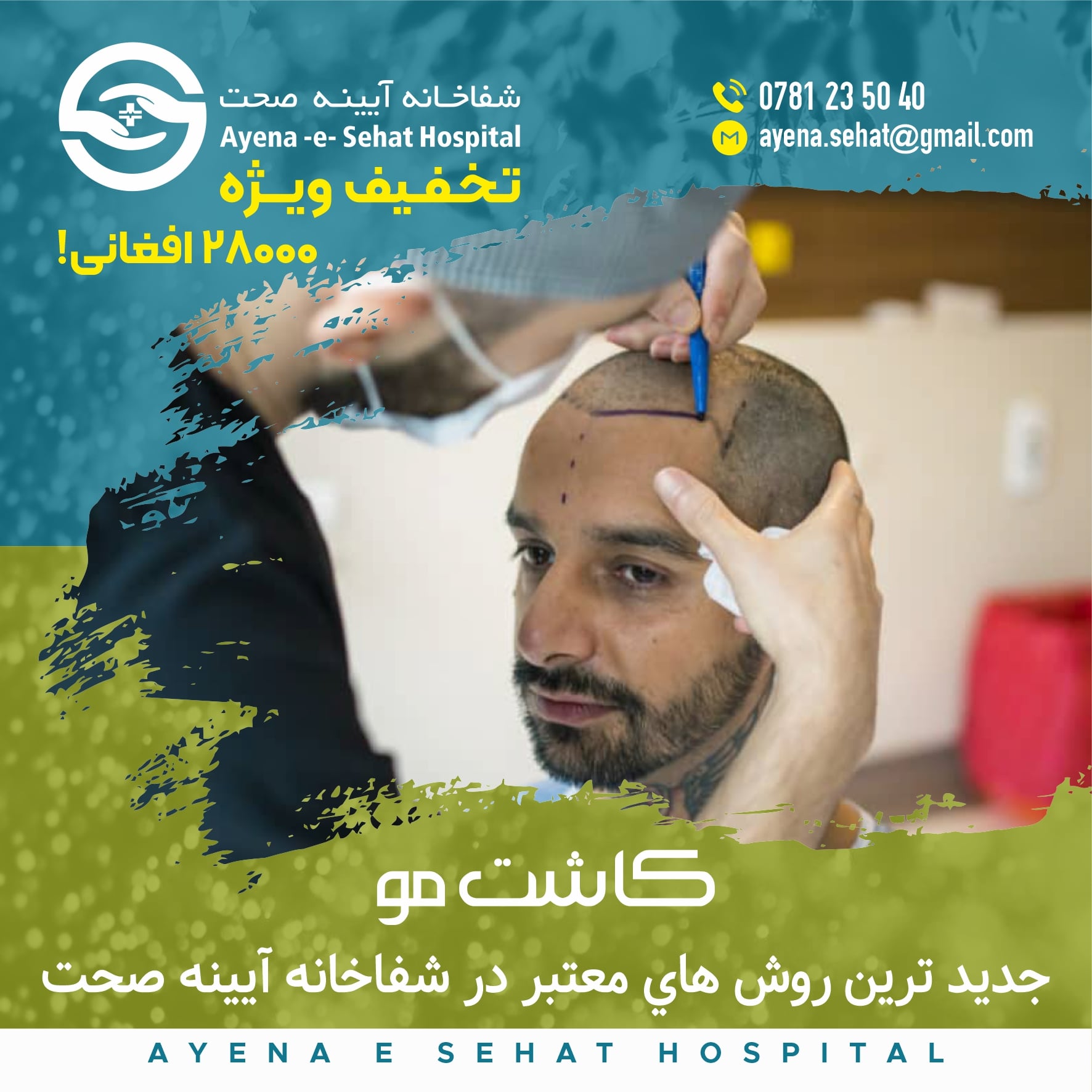 #كاشت_مو_طبيعى_با_ر... - داکتر میوند حبیب- متخصص جلدی و زیبائی | Facebook