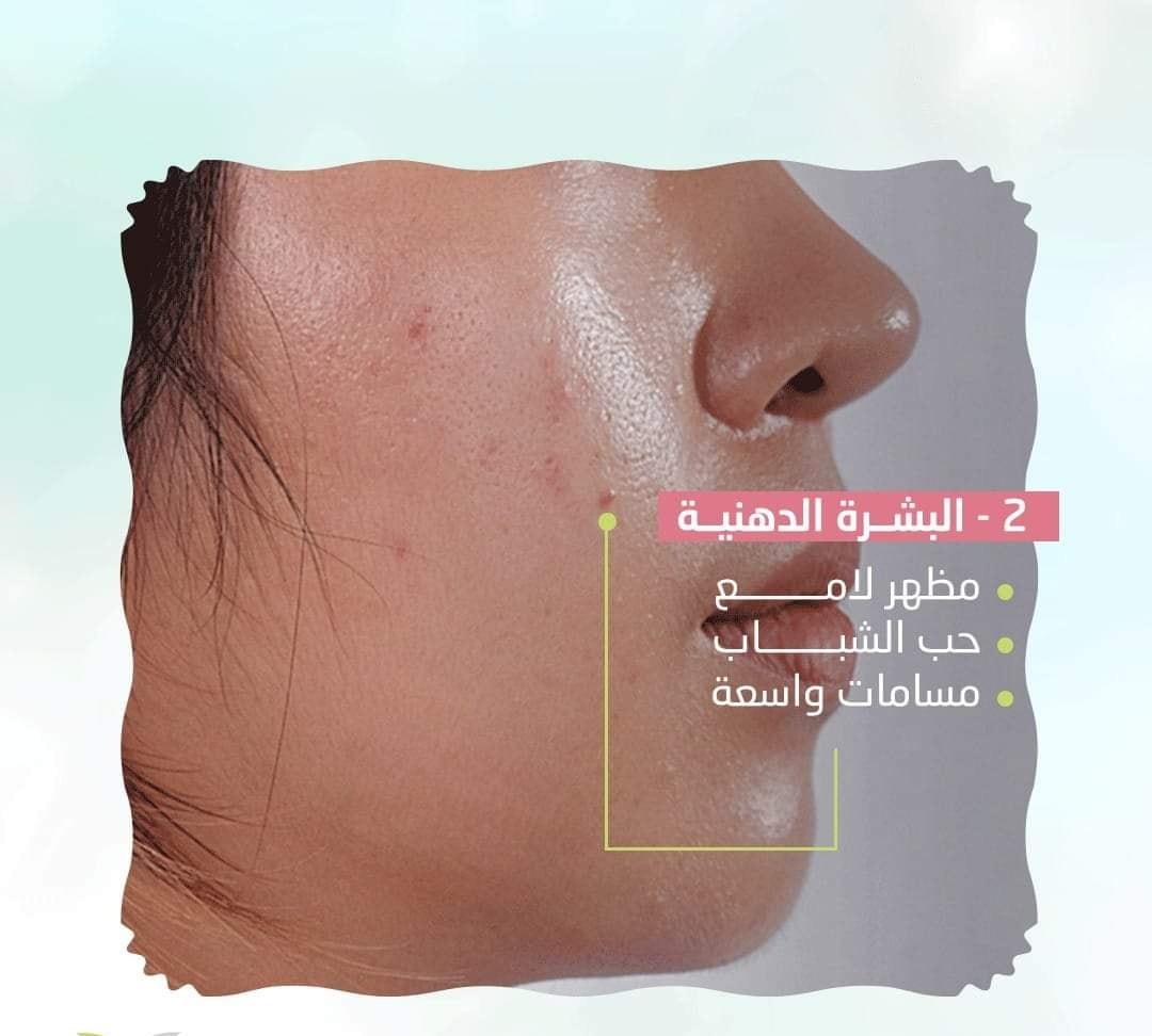 Shaimaa لأحدث طرق فرد الشعر