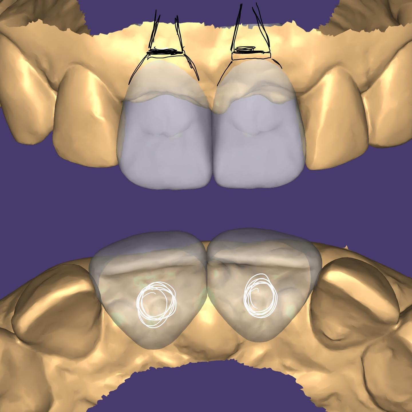 Distal, mesial, buccal,... - Midwest Dental Arts, Inc.