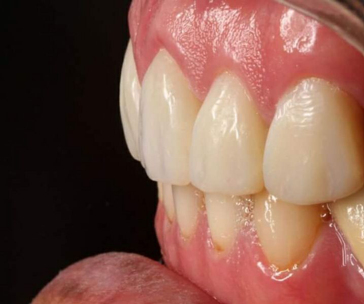 Asignatura Endodoncia A... - Asignatura Endodoncia A FOLP