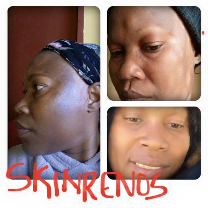 Skin Renos Durban... - Skin Renos Durban Distributor