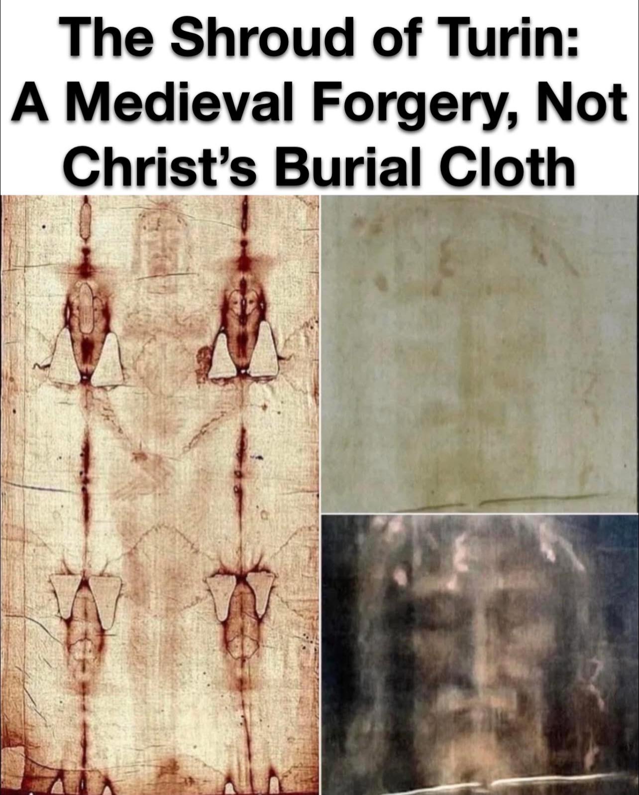 Shroud of Turin is a medieval forgery, not Christ