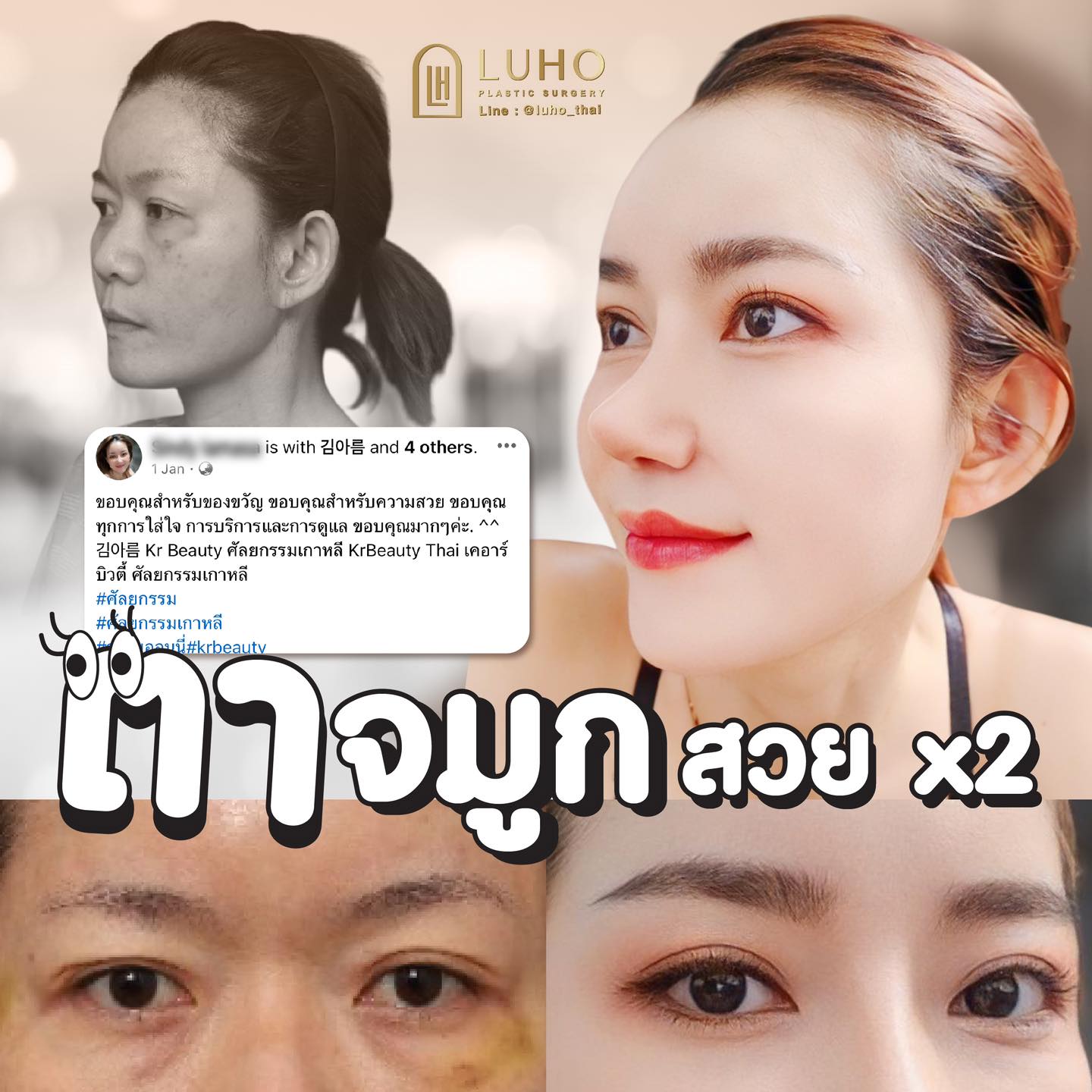 อยากหน้าเปลี่ยน ออนนี่แนะนำ... - โรงพยาบาลศัลยกรรมเกาหลี LUHO | Facebook