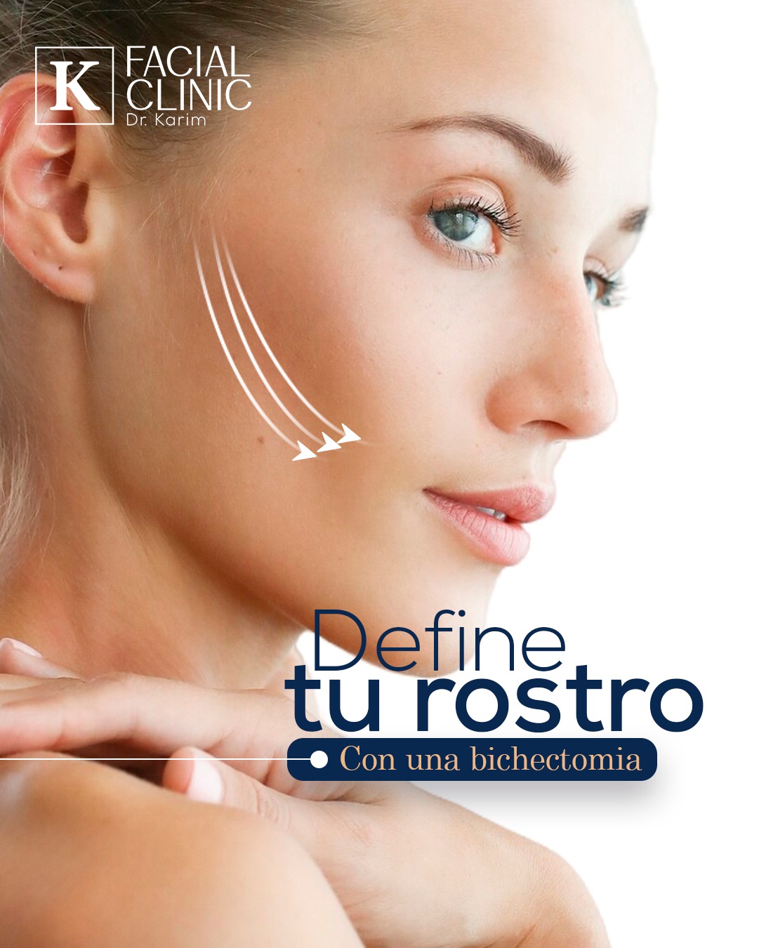 Define tu rostro con la bichectomía... - Facial Clinic Karim | Facebook