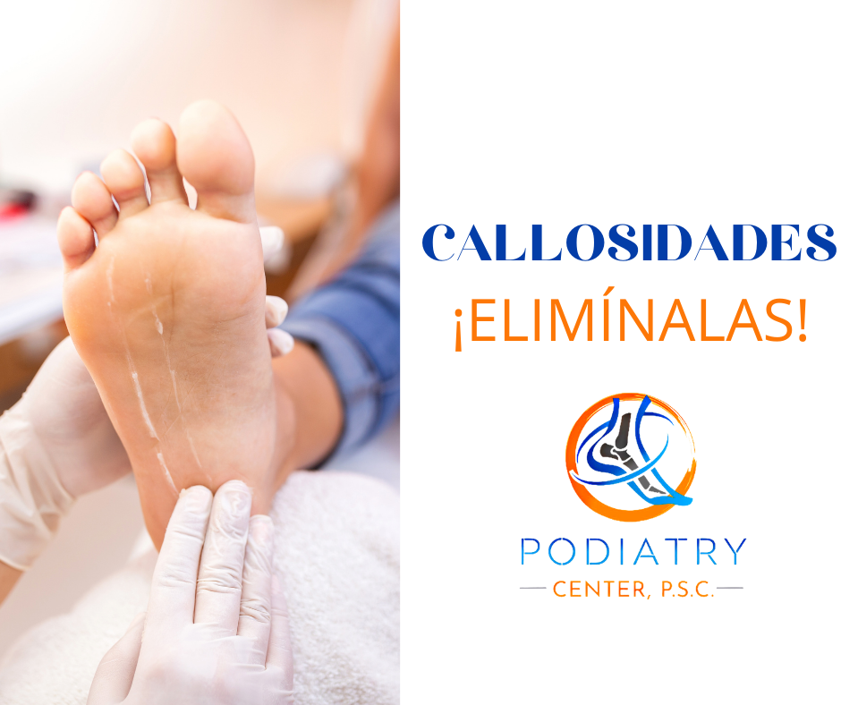 Los callos son causados por la... - Podiatry Center, PSC | Facebook