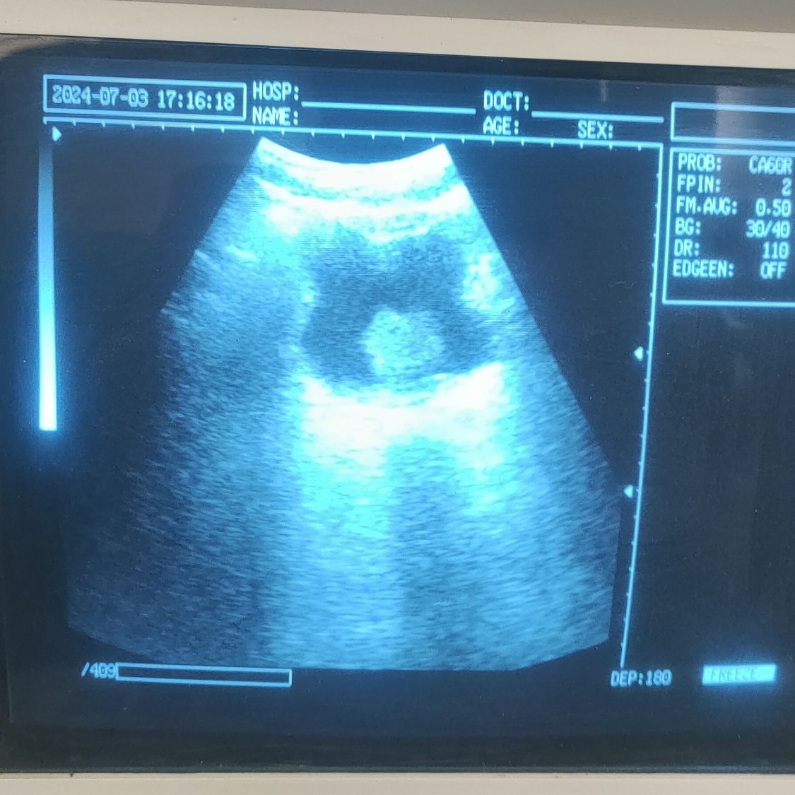 Ultrasound Techs Resource | 45 year old man present with painfully ...