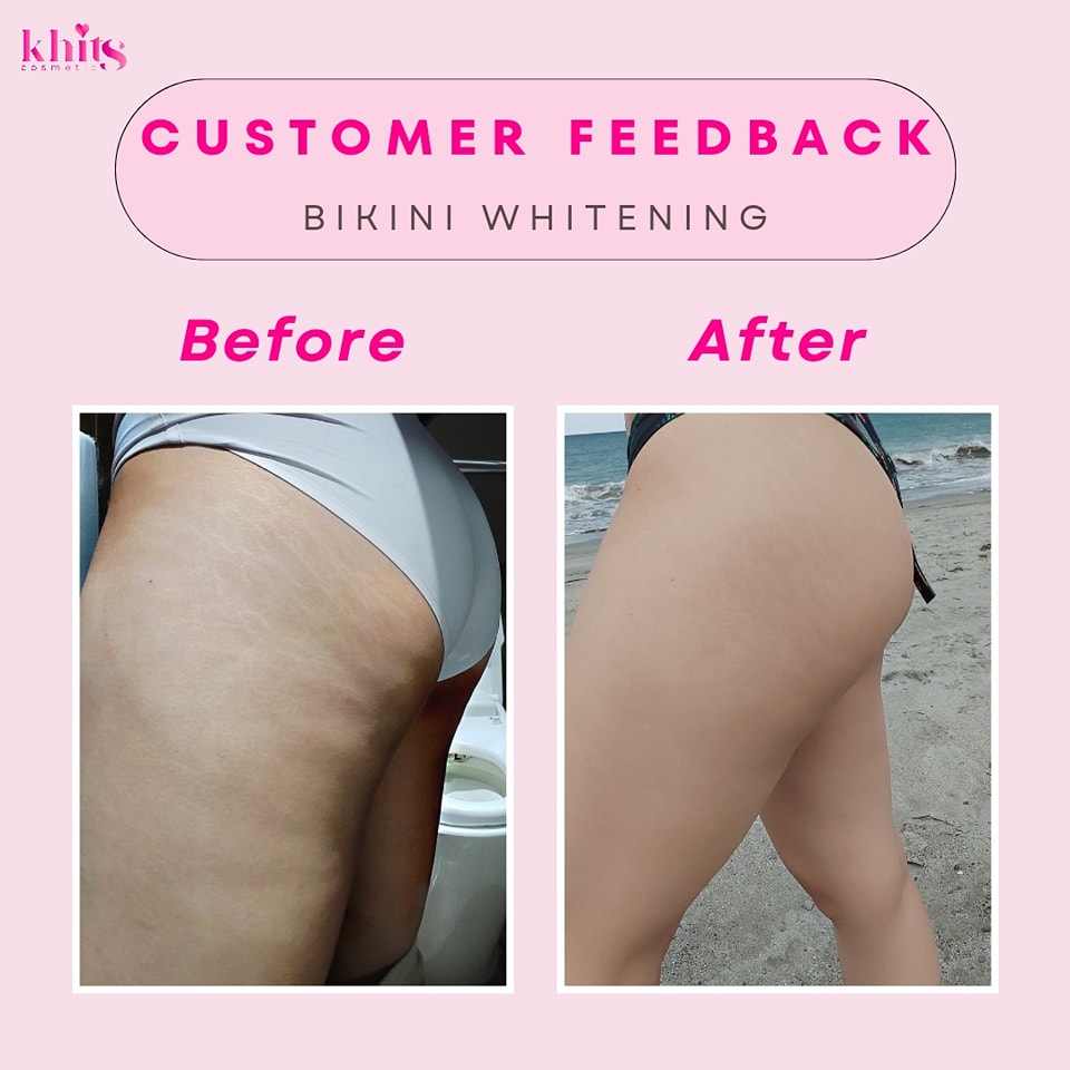 can glutathione whiten bikini area 💗𝙂𝙡𝙤𝙬𝙞𝙣𝙜 𝙗𝙞𝙠𝙞𝙣𝙞 𝙖𝙧𝙚𝙖 𝙞𝙣𝙙𝙚𝙚𝙙💗 Body Love Cream feedback✨ Introducing our Bestseller!✨ Body love cream is a must for those who wants to lighten and heal their underarms, area, scars.. and many Under Eye Hot Sale Wholesale Factory Quantity:30