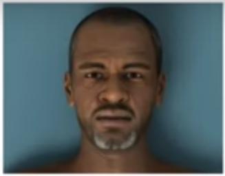 James Wilkins ACLS Bradycardia